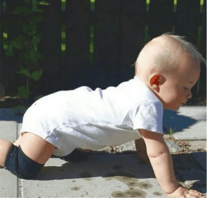 Premium Anti-Slip Baby Knee Pads for Crawling, Breathable & Adjustable (1 Pair)